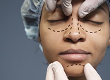 Mujer joven con ojos cerrados y líneas dibujadas para la intervención de cirugía de nariz